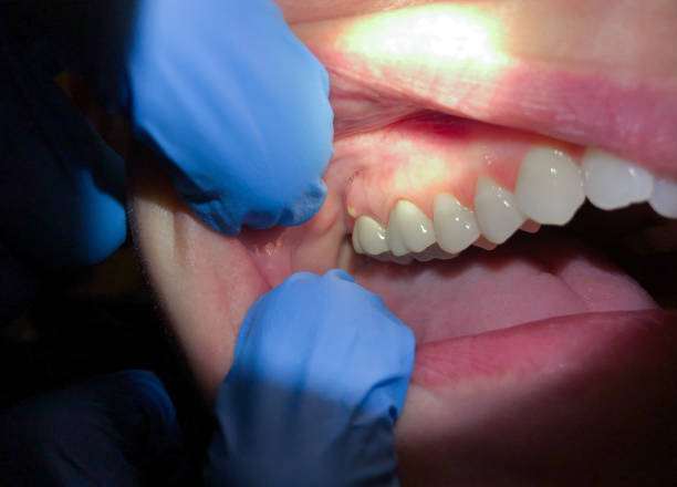 Best Same-Day Emergency Dental Services in Gholson, TX